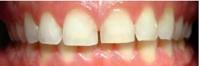 Dentist in Cranbourne – Dentistree image 1